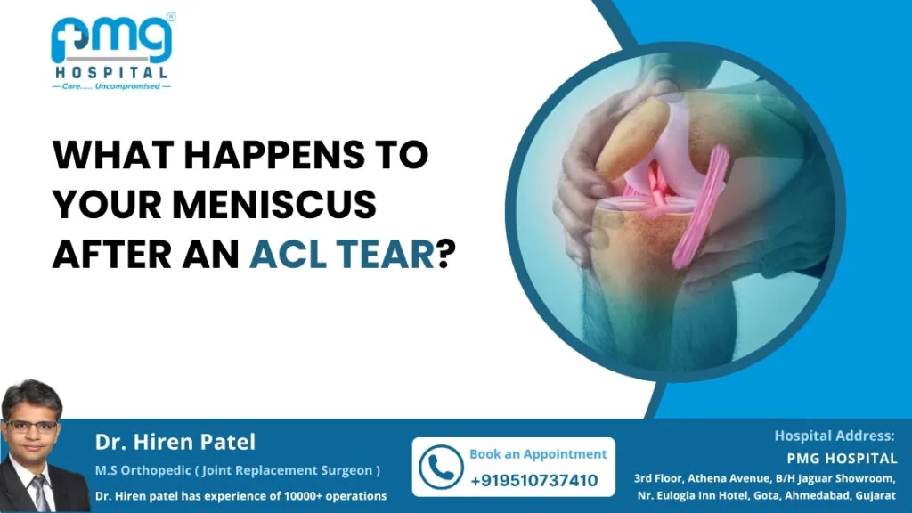 Meniscus Repair Hospital in Ahmedabad