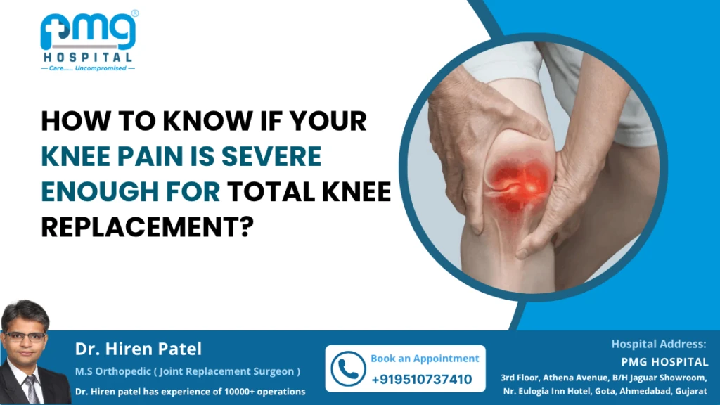 When Does Knee Pain Require Replacement Surgery?