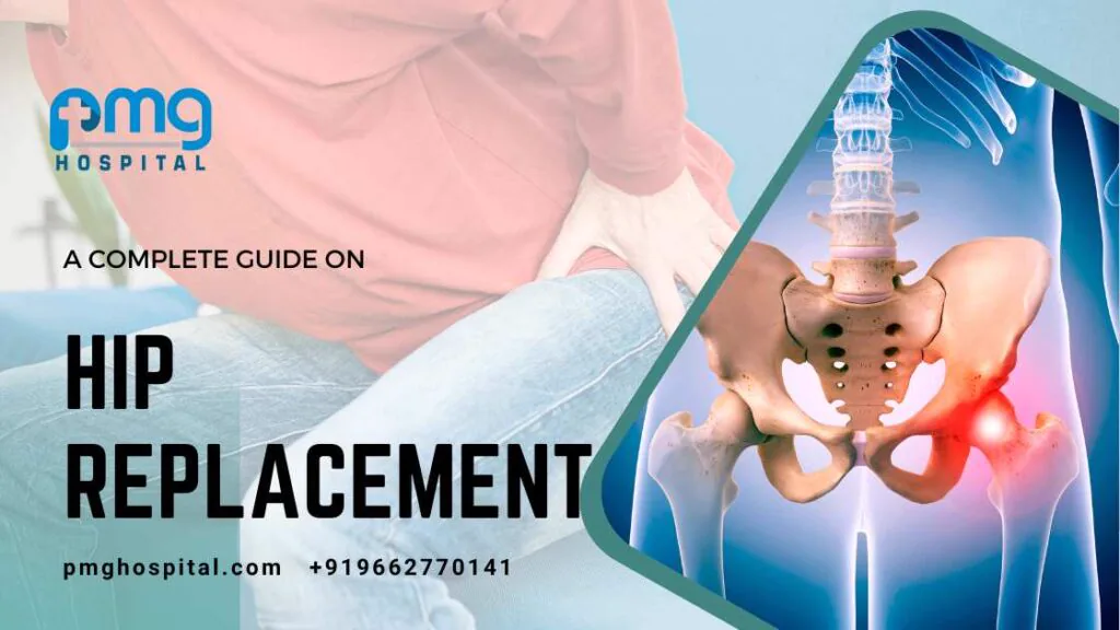 Complete Guide on Hip Replacement Surgery in Ahmedabad