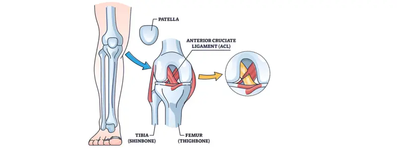Cartilage Restoration Hospital in Ahmedabad