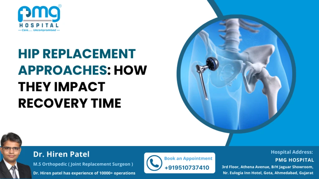 Hip Replacement Approaches: How They Impact Recovery Time