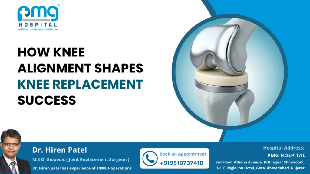 How Knee Alignment Shapes Knee Replacement Success