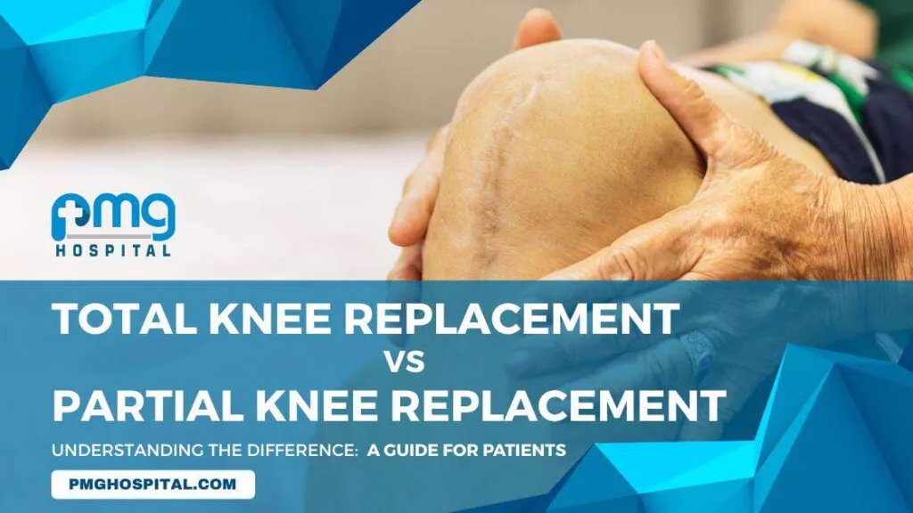 Total Vs Partial Knee Replacement Surgery