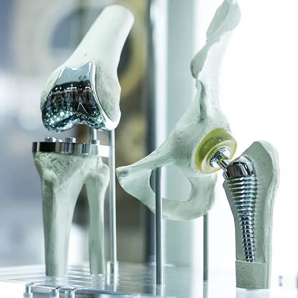 Joint Replacement Hospital in Ahmedabad
