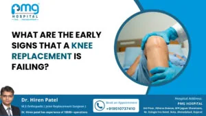 What Are the Early Signs That a Knee Replacement Is Failing?