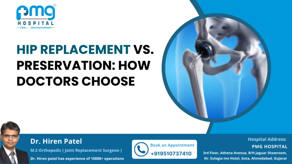 Hip Replacement vs. Preservation: How Doctors Choose