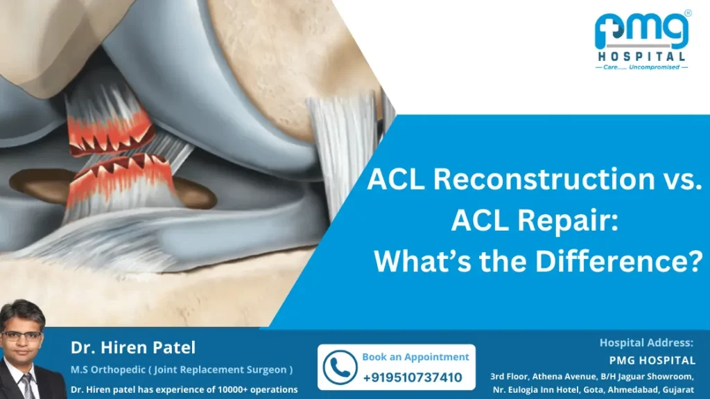 ACL Reconstruction vs. ACL Repair: What’s the Difference?