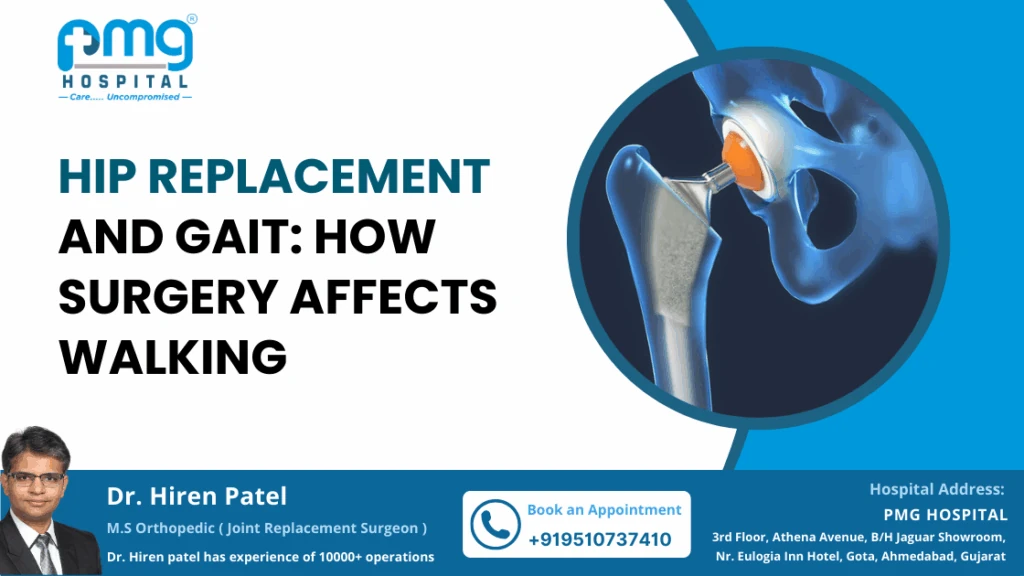 Hip Replacement and Gait: How Surgery Affects Walking