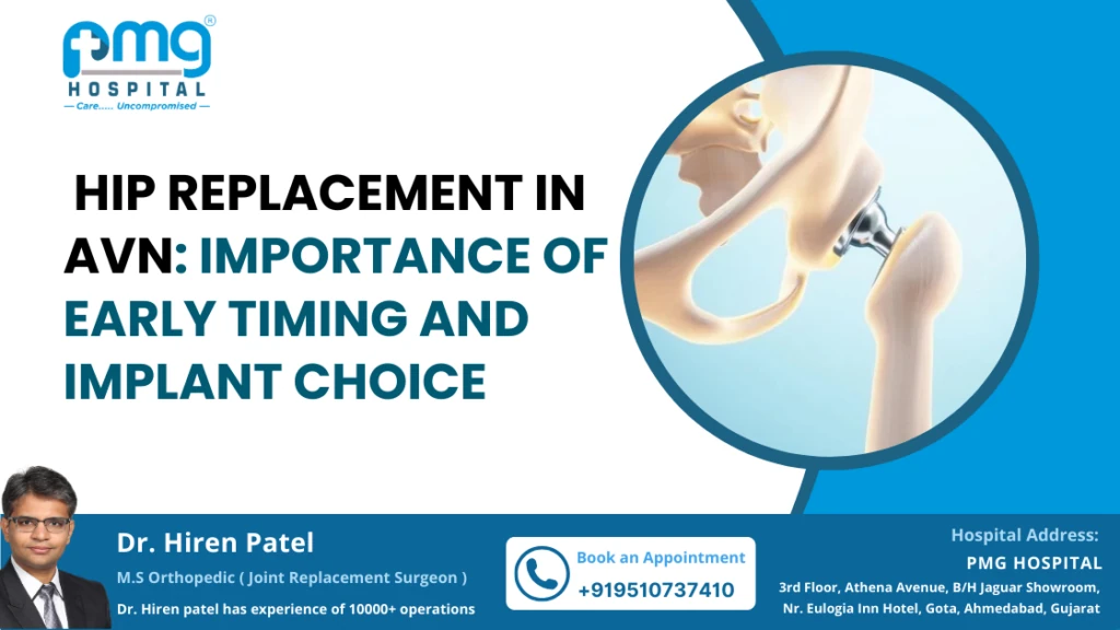 Hip Replacement in AVN: Timing and Implant Matters